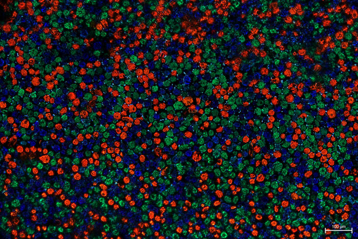 Mikroskopisches Foto von Cinécolor
